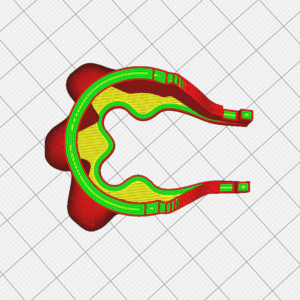 Motor Protection STL (LM1)